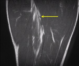 2002_07_17_15_03_35_706